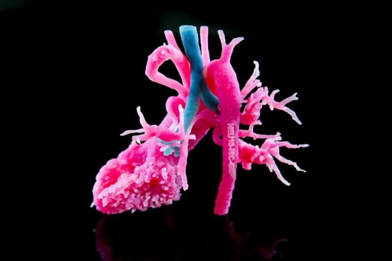 3D-printed20anatomical20model_heart_Materialise-e1522930804688